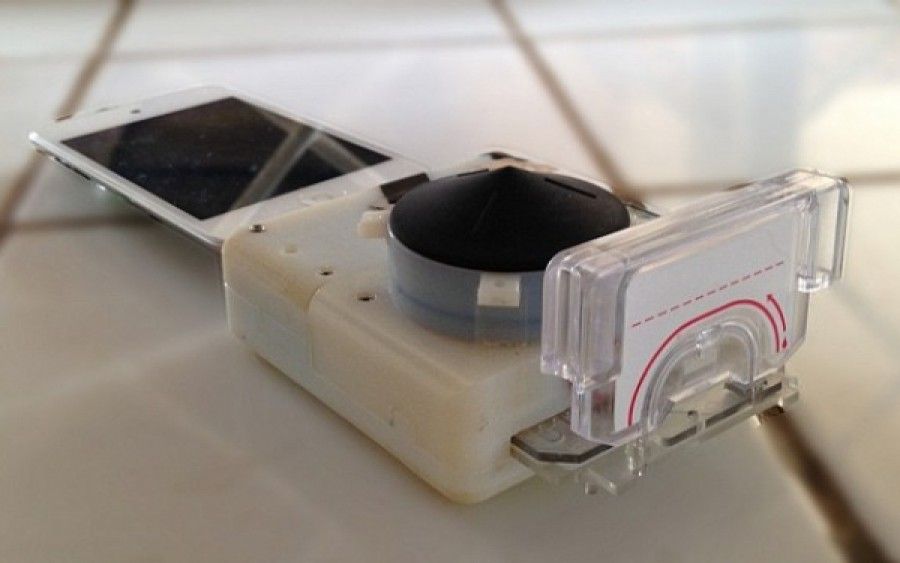 Διάγνωση HIV και σύφιλης μέσα σε 15' με πρωτοποριακή συσκευή (vid)