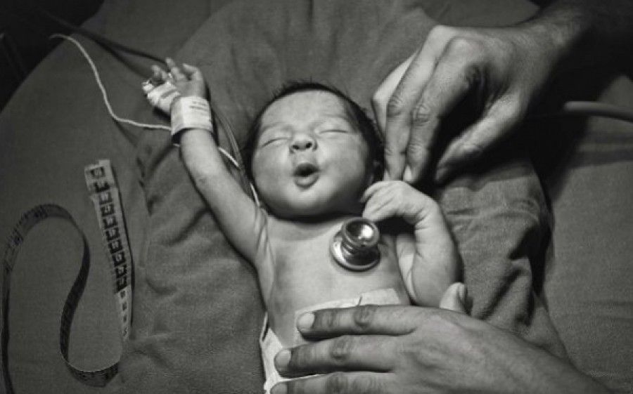 Τεστ Apgar: Τι είναι και γιατί πρέπει να γίνεται στο 5ο λεπτό της ζωής ενός νεογέννητου;