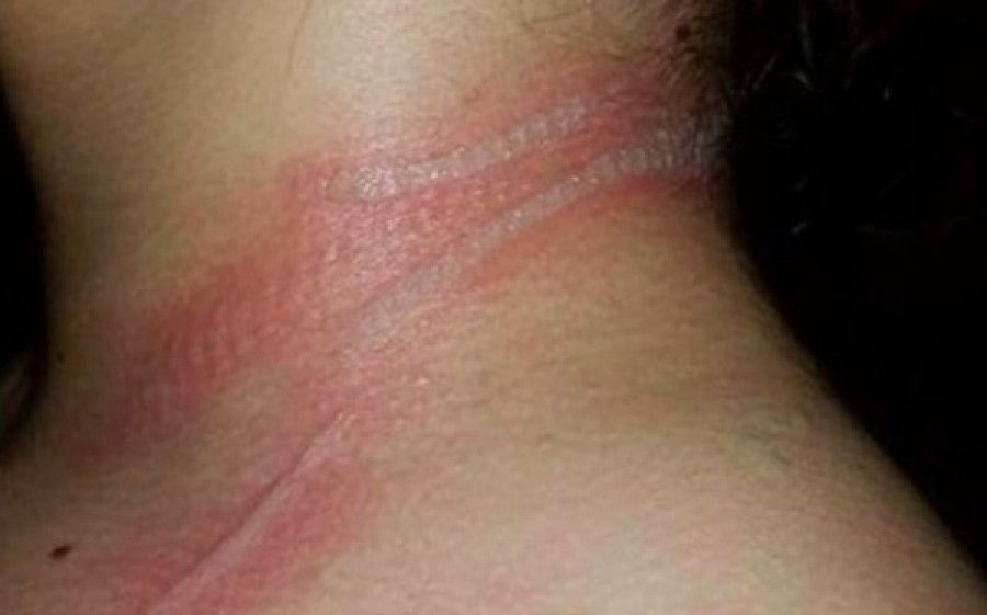 Η κόρη της ούρλιαζε από πόνο και εκείνη δεν ήξερε γιατί. Τώρα προειδοποιεί και τους άλλους γονείς!