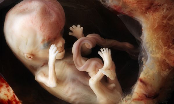 Ρεαλιστικές φωτογραφίες: Καρέ καρέ η ανάπτυξη του εμβρύου μέσα στη μήτρα