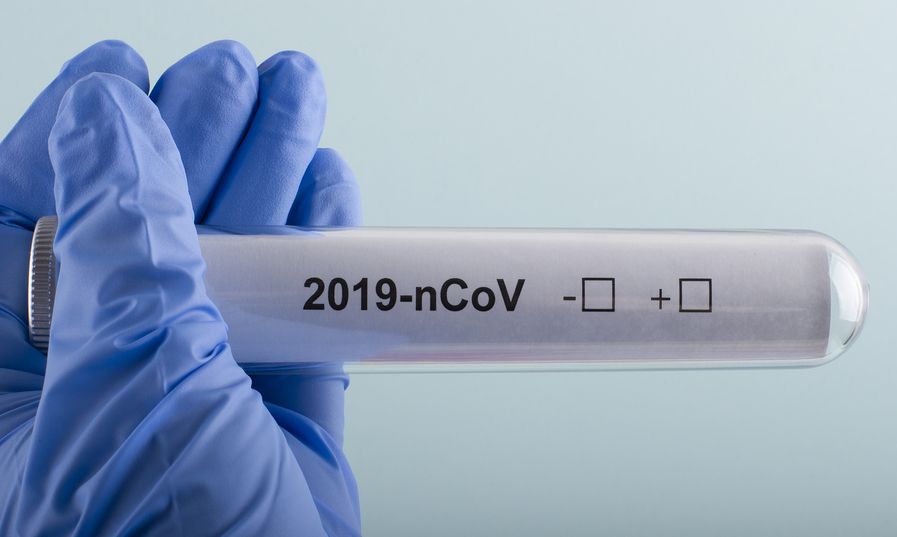 Κορονοϊός: 98 θάνατοι στην Ελλάδα - 33 νέα κρούσματα - 2.114 στο σύνολο