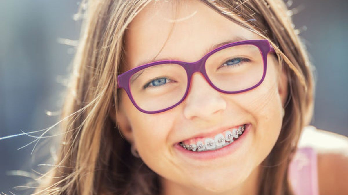 Κορoνοϊός: Τι πρέπει να προσέχουν τα παιδιά που φορούν σιδεράκια (pics)