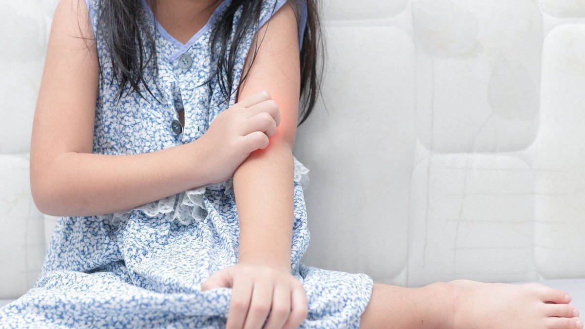 Ψωρίαση στα παιδιά: Πού οφείλεται και πώς αντιμετωπίζεται