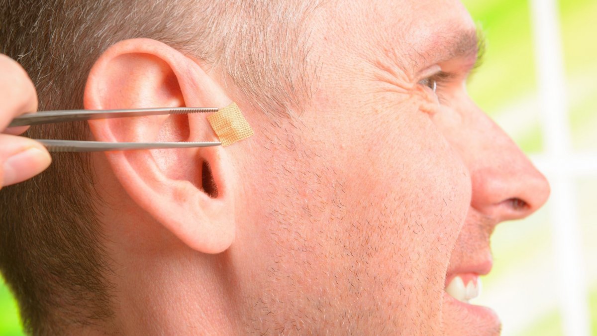 Ear seeding: Όλα όσα πρέπει να ξέρετε για την αρχαία ωτοθεραπευτική μέθοδο