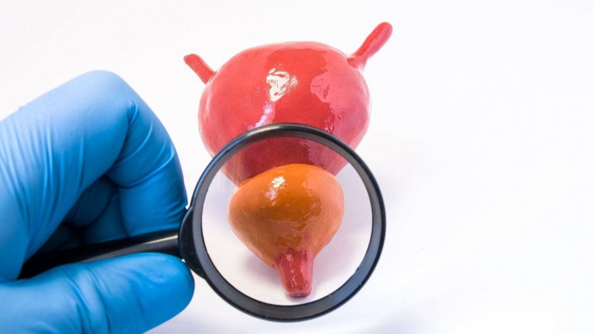 Καρκίνος προστάτη: Μέχρι ποια ηλικία είναι πραγματικά χρήσιμος ο προληπτικός έλεγχος