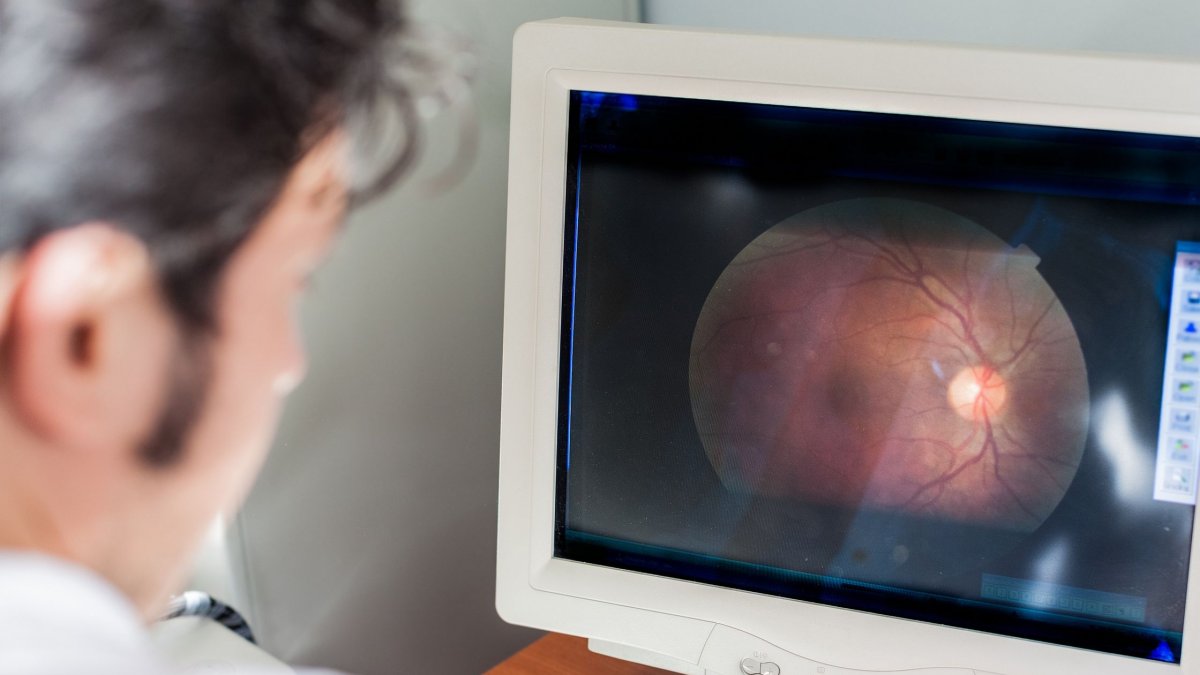 Οφθαλμολογική απεικόνιση μπορεί να αποκαλύψει κίνδυνο για την καρδιακή υγεία