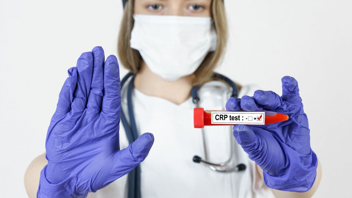 Τι είναι η CRP στις εξετάσεις αίματος — Τι δείχνει η hs-CRP για την καρδιά