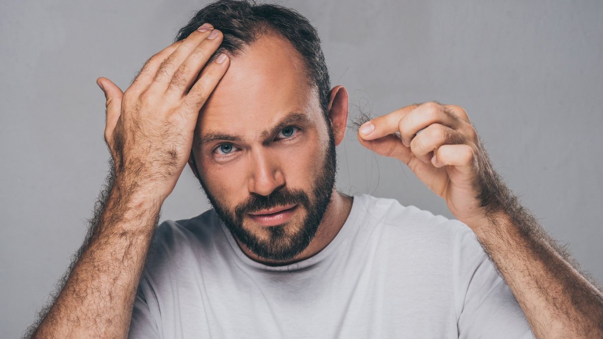 Ξαφνική απώλεια μαλλιών: 14 αιτίες και πώς αντιμετωπίζονται