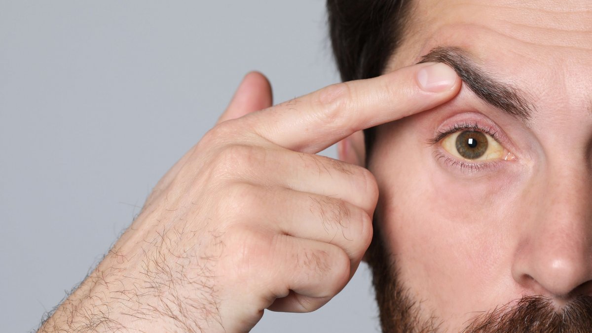 Παγκόσμια Ημέρα Καρκίνου του Παγκρέατος: Στο επίκεντρο η αναγνώριση των πρώτων συμπτωμάτων