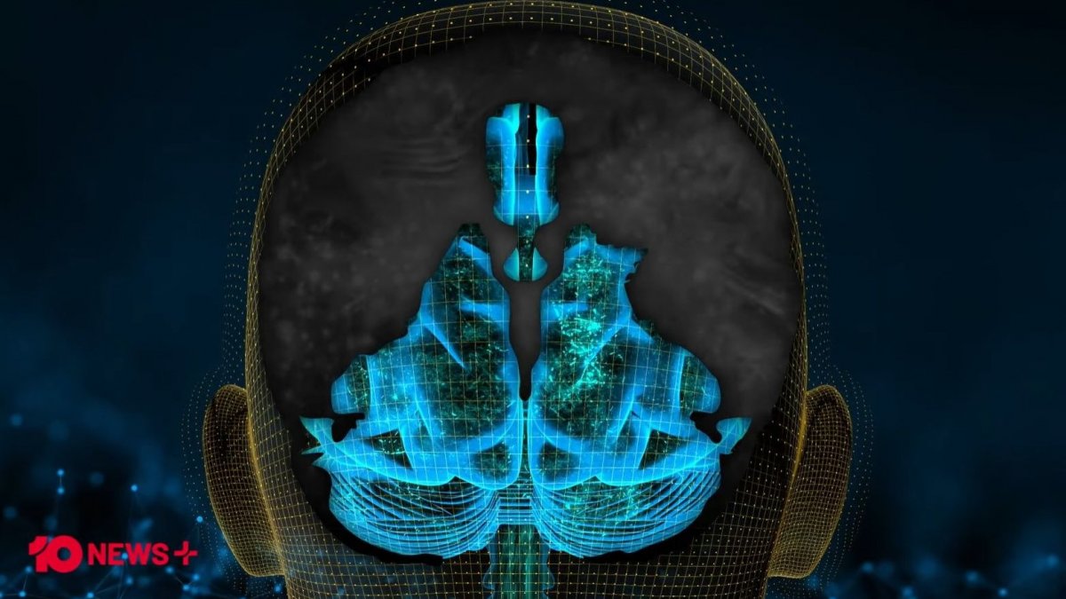 Γεννήθηκε χωρίς ημισφαίρια εγκεφάλου αλλά μόλις έκλεισε τα 20 – Τι είναι η υδρανεγκεφαλία [vid]