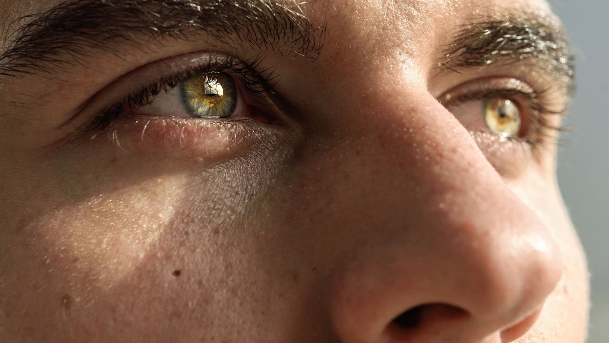 Αλλαγή χρώματος ματιών: Πρώτη επιτυχημένη επέμβαση στην Ελλάδα με τη μέθοδο FLAAK