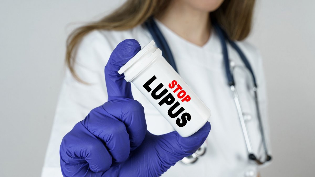 Ο Λύκος συνδέεται με ιό που φέρει το 95% των ανθρώπων – Πλέον ξέρουμε και πώς