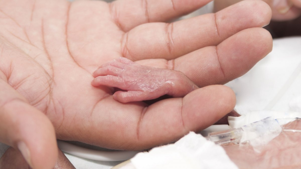 Πρόωρος τοκετός και κακή ανάπτυξη καταδικάζουν 1 στα 5 παιδιά κάτω των 5 ετών - Έρευνα