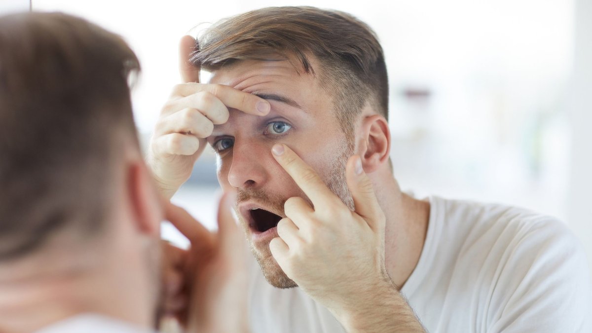 Γιατί ξυπνάτε με κατακόκκινα μάτια; Πότε είναι αιτία ανησυχίας