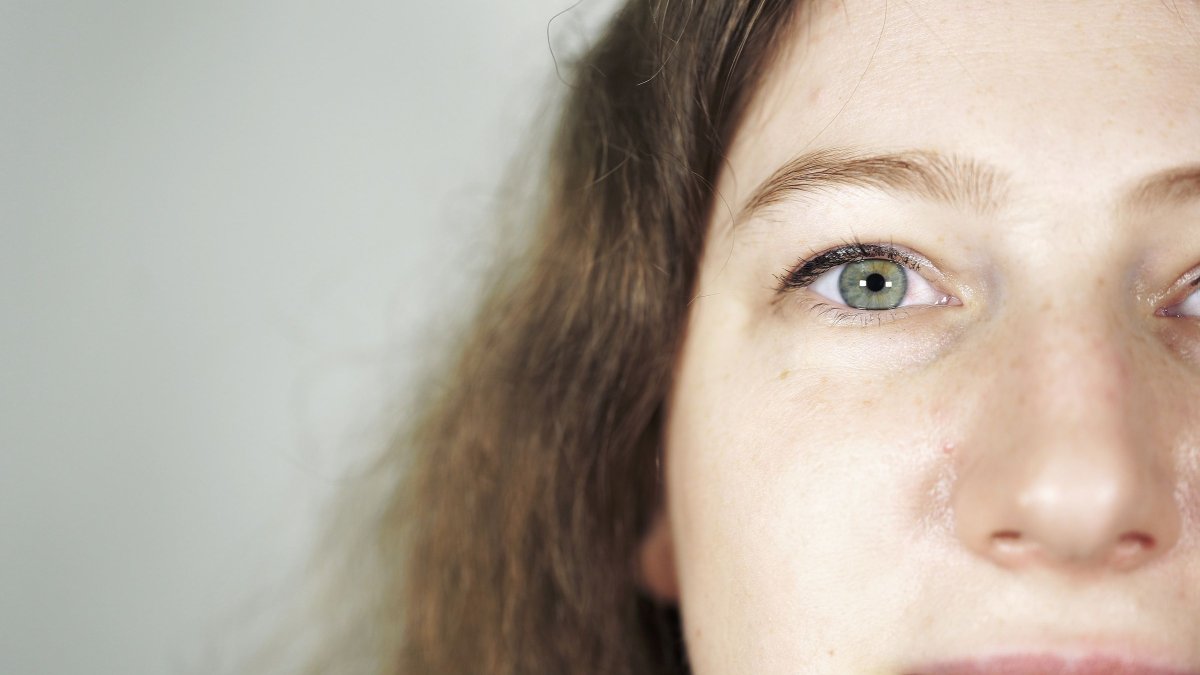 Πώς η νεφρική νόσος επηρεάζει το πρόσωπο: Ποιες αλλαγές σηματοδοτούν πιθανό πρόβλημα