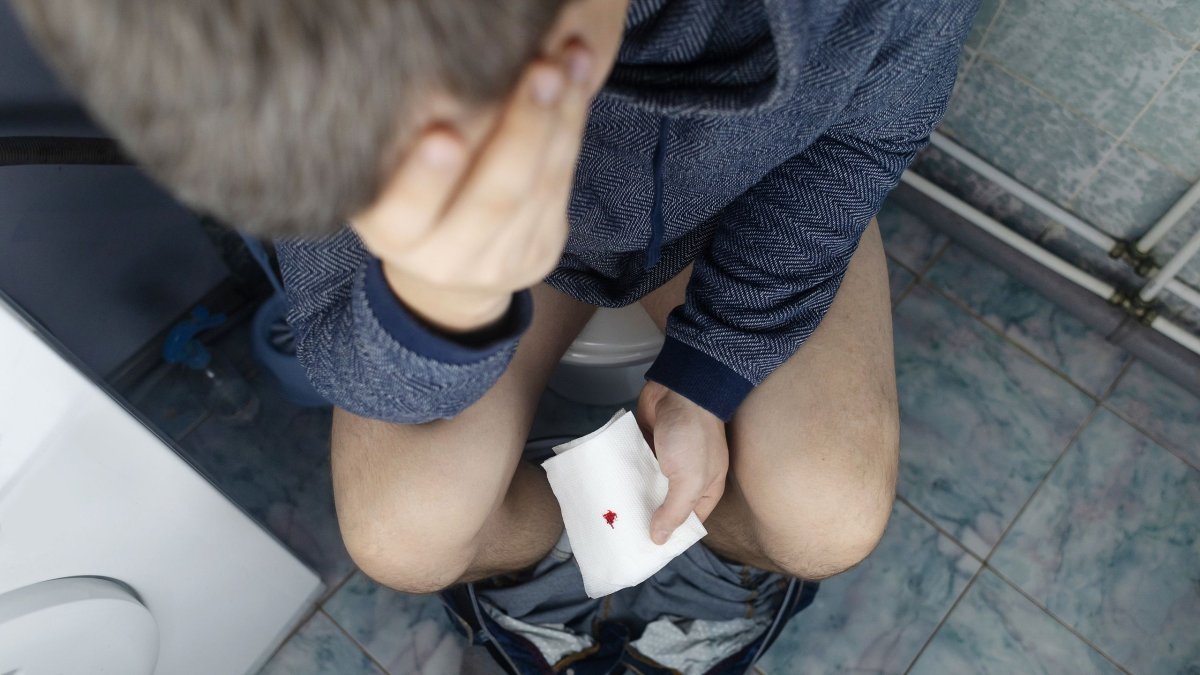 Πώς είναι το αίμα από αιμορροΐδες και πώς από καρκίνο εντέρου