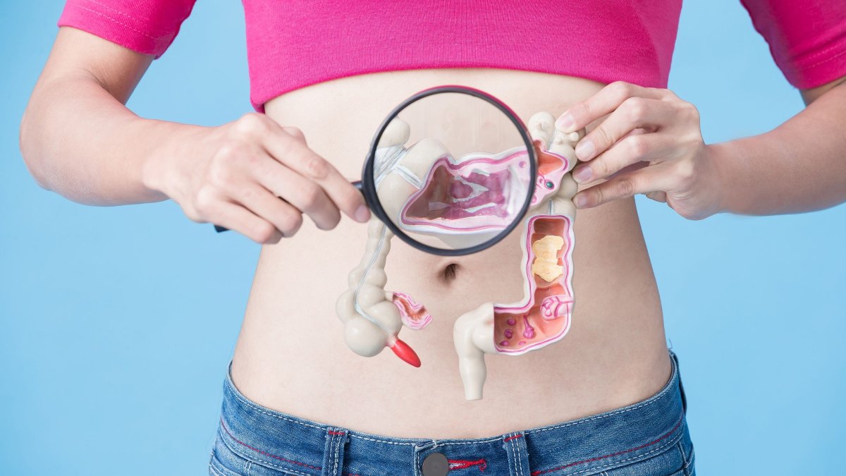 Σε άνοδο οι καρκίνοι του γαστρεντερικού στους νέους - Το μικροβίωμα στο επίκεντρο της έρευνας