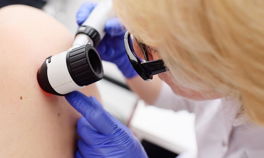 «Εμβόλιο» για το μελάνωμα: Συνδυαστική θεραπεία μειώνει τον κίνδυνο υποτροπής ή θανάτου κατά 49%