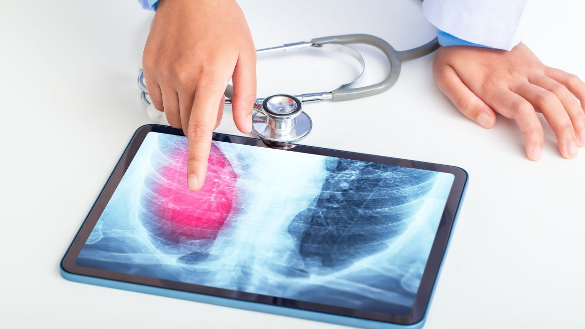 Πνευμονιόκοκκος: Ο «αόρατος» εχθρός των πνευμόνων - Συνεχίζεται η νοσηλεία της Σίας Κοσιώνη