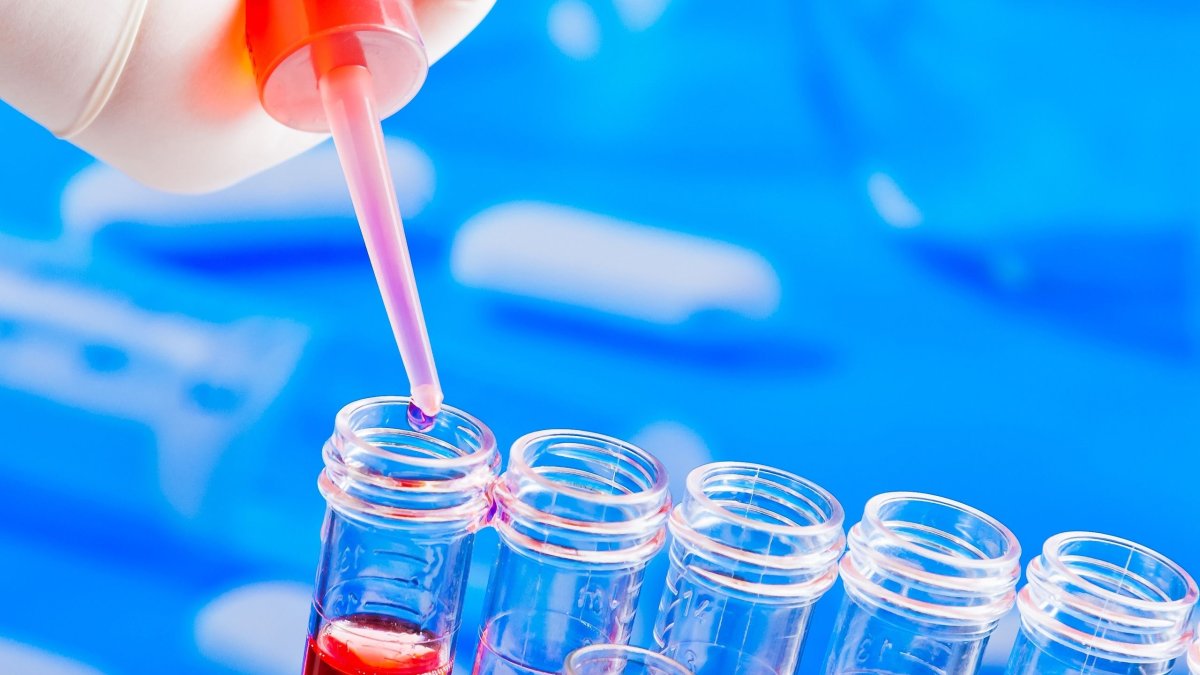 Τα πρώιμα σημάδια Πάρκινσον μπορούν να εντοπιστούν στο αίμα