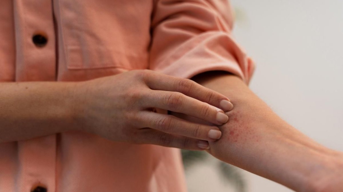 Ατοπικό δέρμα: Πώς η σωστή περιποίησή του αποκαθιστά τον δερματικό φραγμό
