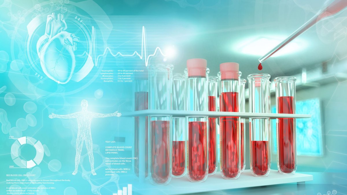 Υπερκαλιαιμία: Τι σημαίνει το αυξημένο κάλιο στο αίμα και οι πιθανές αιτίες