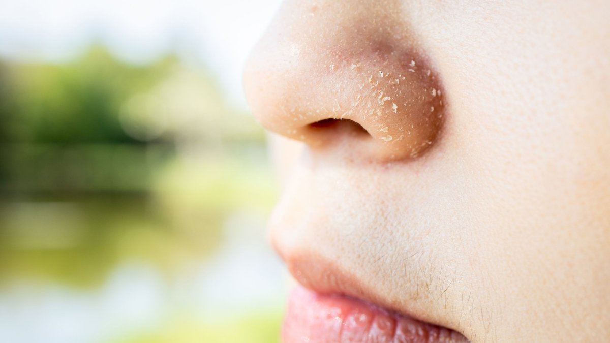 Σημάδια και συμπτώματα ανεπάρκειας βιταμίνης Β6