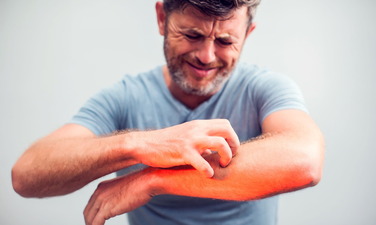 &Pi;ώ&sigmaf; &nu;&alpha; &mu;&epsilon;&iota;ώ&sigma;&epsilon;&tau;&epsilon; &tau;&eta; &phi;&alpha;&gamma;&omicron;ύ&rho;&alpha; &tau;&omicron;&upsilon; &epsilon;&kappa;&zeta;έ&mu;&alpha;&tau;&omicron;&sigmaf; &chi;&omega;&rho;ί&sigmaf; &nu;&alpha; &tau;&omicron; &epsilon;&pi;&iota;&delta;&epsilon;&iota;&nu;ώ&sigma;&epsilon;&tau;&epsilon;