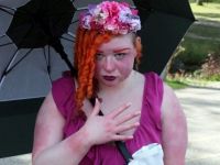 Η 25χρονη που πάσχει από το «Σύνδρομο του Φλεγόμενου Ανθρώπου» (pics&vid)