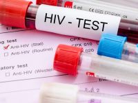HIV Aids: Με προσδοκίες το νέο πρόγραμμα δωρεάν γρήγορης & ανώνυμης εξέτασης