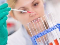 Καρκίνος του πνεύμονα: Θεραπεία της MSD υπερδιπλασιάζει την επιβίωση