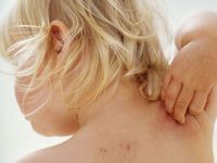 Θετικά αποτελέσματα είχε το dupilumab σε παιδιά 6 -11 ετών με σοβαρή Ατοπική Δερματίτιδα