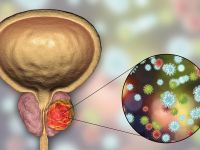 Καρκίνος του προστάτη: Τι ανακάλυψαν για τη θεραπεία με ολαπαρίμπη