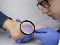 Γιατί έχετε πρήξιμο στα πόδια – Τα 5 σημάδια ότι είναι σοβαρό