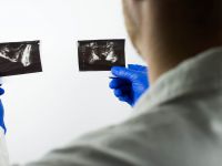 Καρκίνος προστάτη: Έρευνα έδειξε ότι μπορεί να ανιχνευθεί με ταχύτερες τομογραφίες 10 μόλις λεπτών