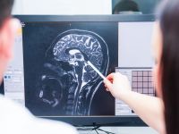 Η νόσος του Χάντινγκτον αντιμετωπίστηκε με επιτυχία για πρώτη φορά στην ιστορία