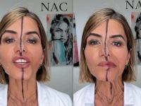 Η γιατρός που έκανε botox μόνο στο μισό της πρόσωπο για να δείξει τις αληθινές επιδράσεις του