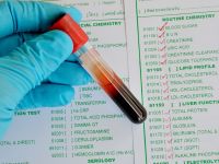 Αυξημένα τριγλυκερίδια: Μια αθόρυβη απειλή χωρίς συμπτώματα - Τι να προσέχετε