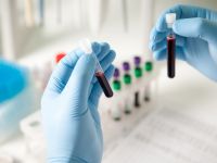 Κλειστά τα ιδιωτικά ιατρικά εργαστήρια στις 7/11 - Γιατί διαμαρτύρονται οι εργαστηριακοί γιατροί