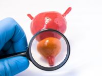 Καρκίνος προστάτη: Μέχρι ποια ηλικία είναι πραγματικά χρήσιμος ο προληπτικός έλεγχος