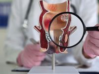 Καρκίνος του Ορθού – Ενδεδειγμένες Θεραπευτικές Επιλογές