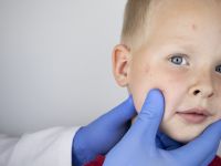 Ποια νόσος που δεν έχει θεραπεία ήταν σε ύφεση, αλλά εξαπλώνεται ξανά παγκοσμίως