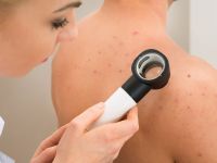 Διαπυητική ιδρωταδενίτιδα: Η δερματική πάθηση που συχνά συγχέεται με ακμή