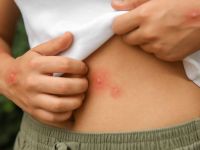 Τι δείχνει αν βγάλετε έκζεμα στο στομάχι – Τι να προσέχετε