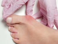 Κότσι: Τι ρόλο παίζει ο τύπος του ποδιού - Το μηλόξυδο και άλλοι μύθοι για τη θεραπεία του