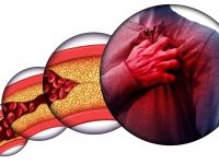 Υψηλά τριγλυκερίδια: Πώς επηρεάζουν τη χοληστερόλη και τον κίνδυνο καρδιακών παθήσεων