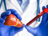 Λίπος στο συκώτι: Φυσιολογικές τιμές - Πότε είναι υψηλό και τι σημαίνουν οι αριθμοί