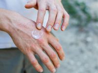 Όλα όσα πρέπει να γνωρίζετε για τις δερματικές λοιμώξεις