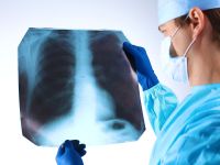 33χρονος επέζησε 2 μέρες χωρίς πνεύμονες - Πώς τον έσωσαν μέχρι να γίνει διπλή μεταμόσχευση