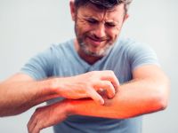 Πώς να μειώσετε τη φαγούρα του εκζέματος χωρίς να το επιδεινώσετε